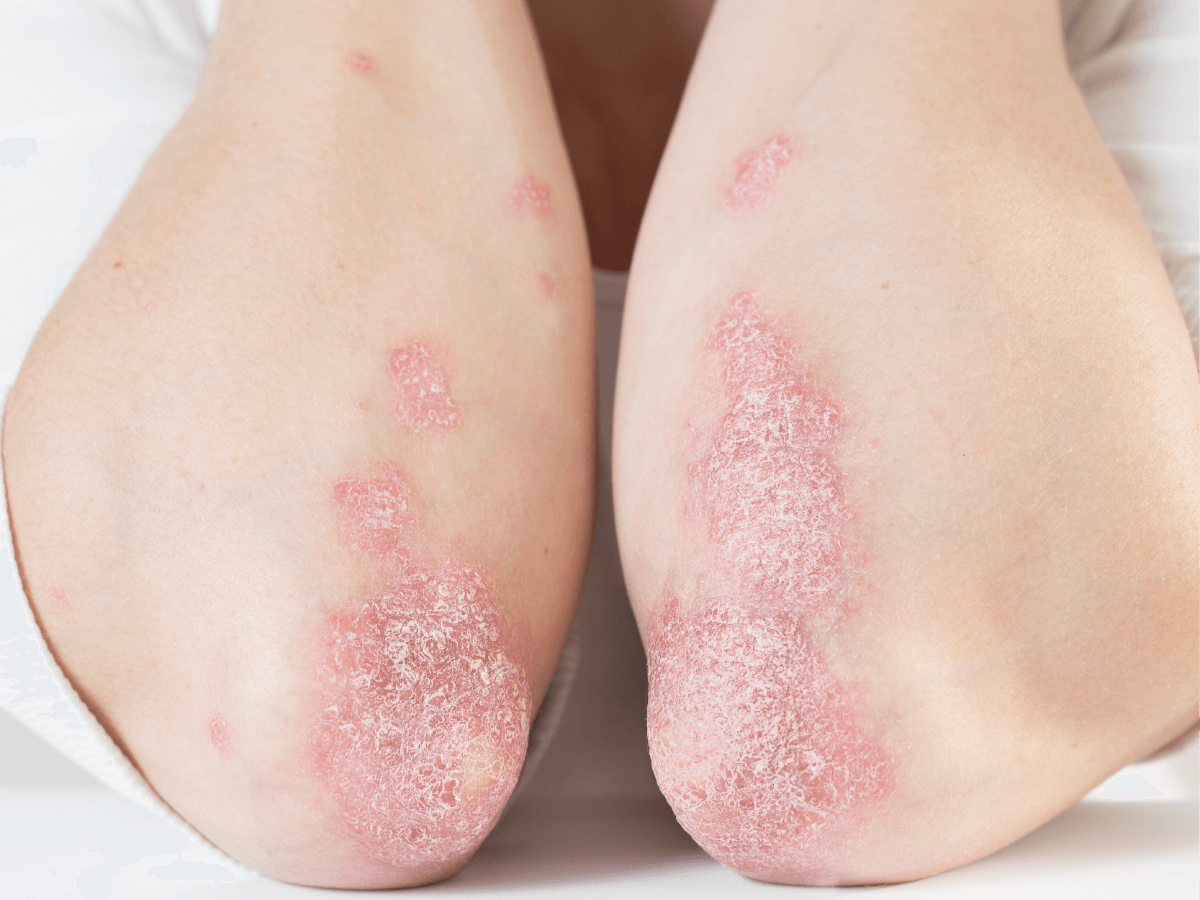 Reconnaître les symptômes pour trouver le <b>bon soin</b>